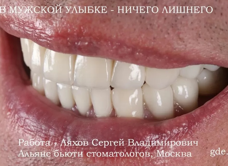 Сбривать нельзя оставить. Стереотипы о мужском бритье (не бороды)