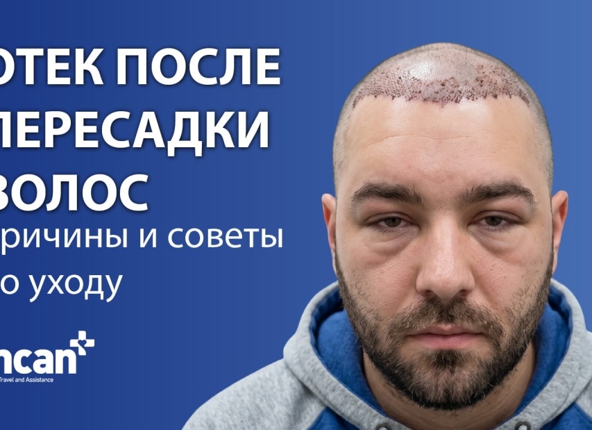 Не растет борода? Несколько советов которые помогут с этим справится